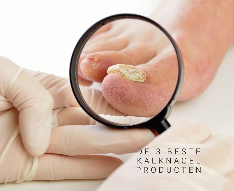 De 3 beste kalknagel producten